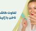 تفاوت کاشت ناخن با ژلیش