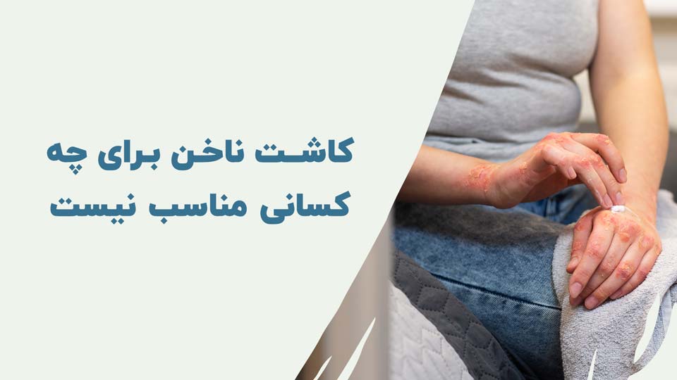 کاشت ناخن برای چه کسانی مناسب نیست؟